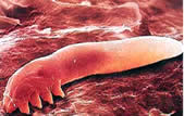 Demodex